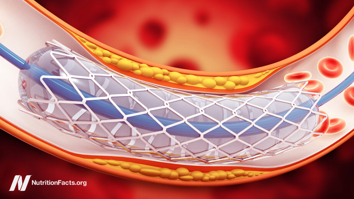 Why Use Stents When They Don’t Work? 