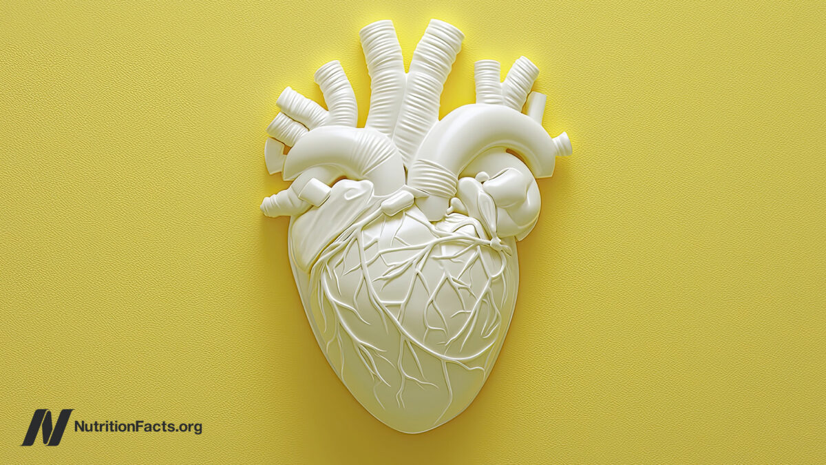 The Risks vs. Benefits of Angioplasty and Heart Stents 