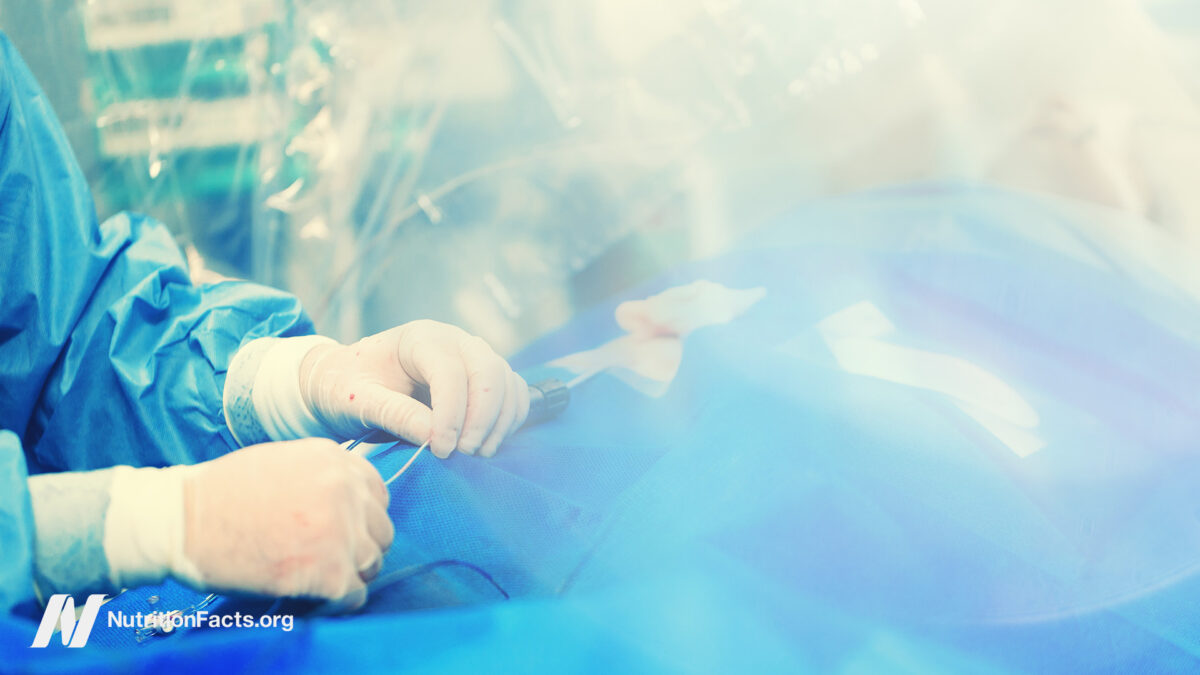The Effectiveness of Angioplasty and Heart Stent Procedures 