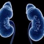 Lower Heart Disease & Diabetes Risk By Eating More Phytosterols