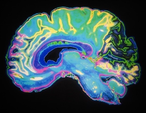 c-Fos exhibits a dual role in memory formation and Alzheimer’s disease