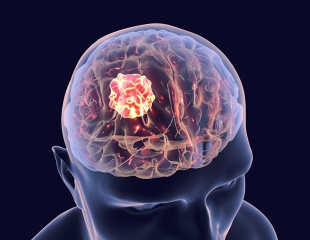 FAU researchers secure key grants to target new gene in the fight against glioblastoma