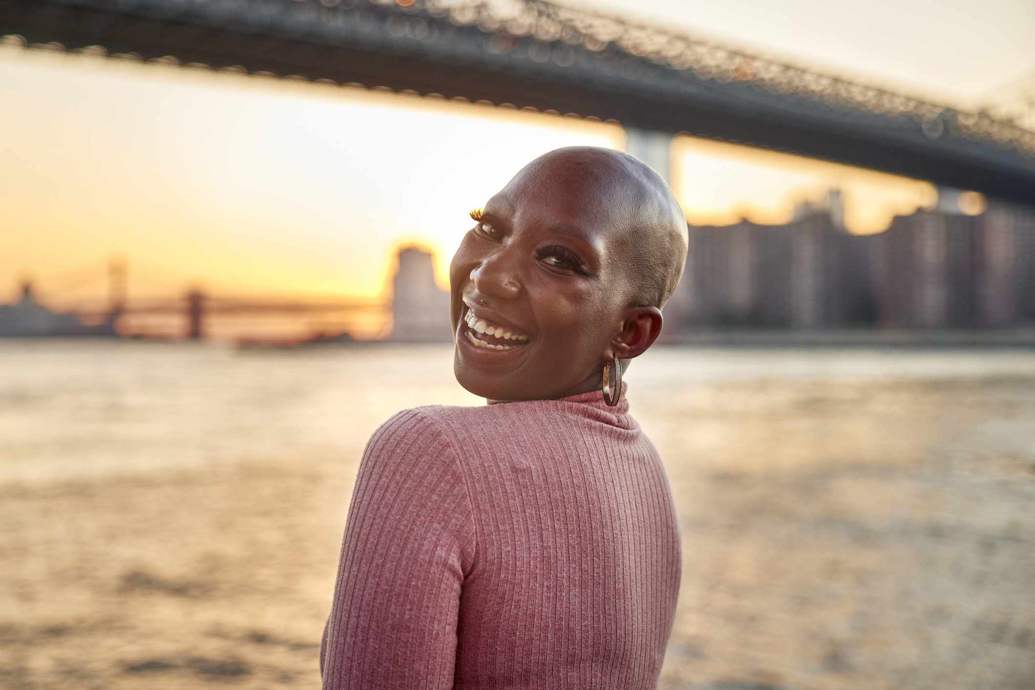 How I Stopped Hiding My Alopecia—And Started Showing Up as Myself