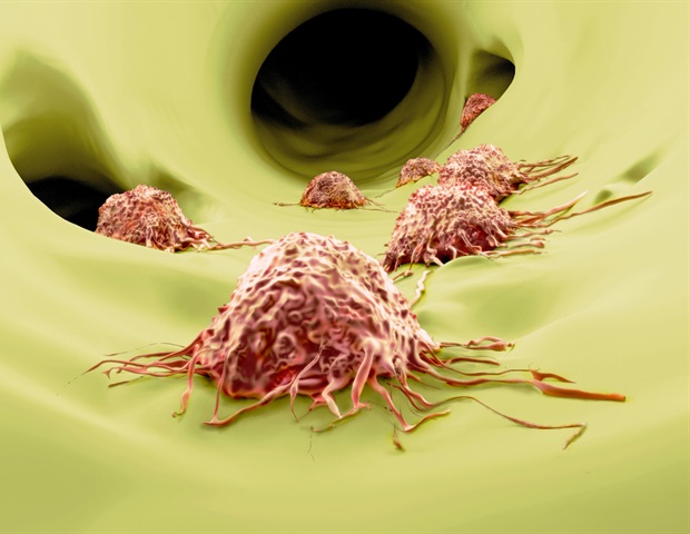New machine learning model brings transparency to risk prediction in medulloblastoma
