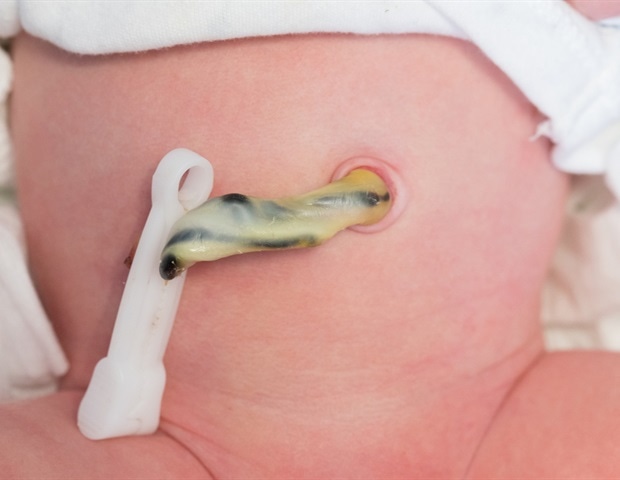 Cord blood proteins help detect early sepsis in preterm infants