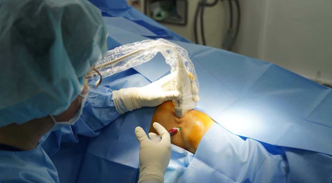Knee Stem Cell Injection Gains Attention as an Innovative