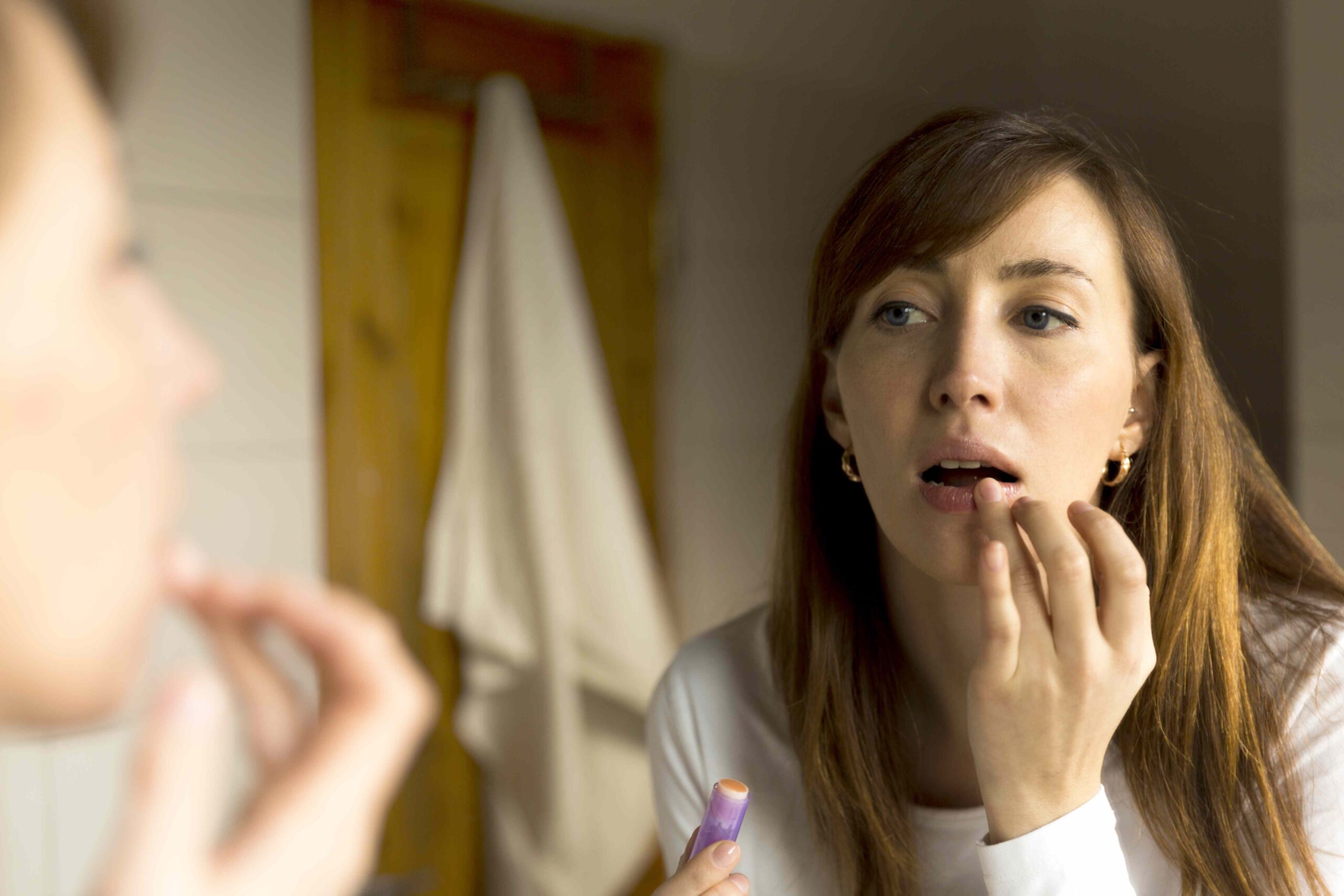 Sunburned Lips: Treatment, Prevention, and More