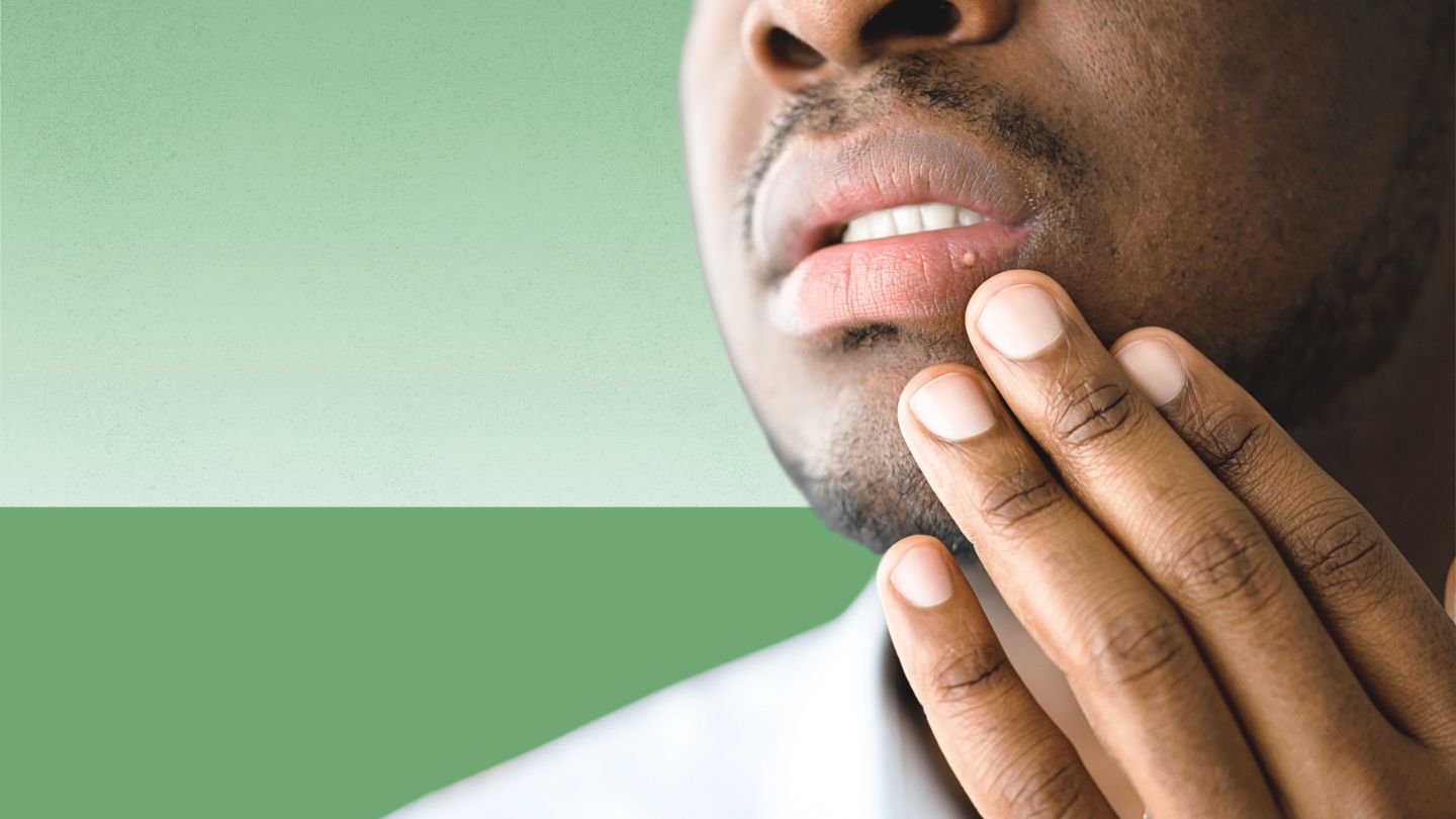 How Do I Know if I Have Herpes or Something Else?