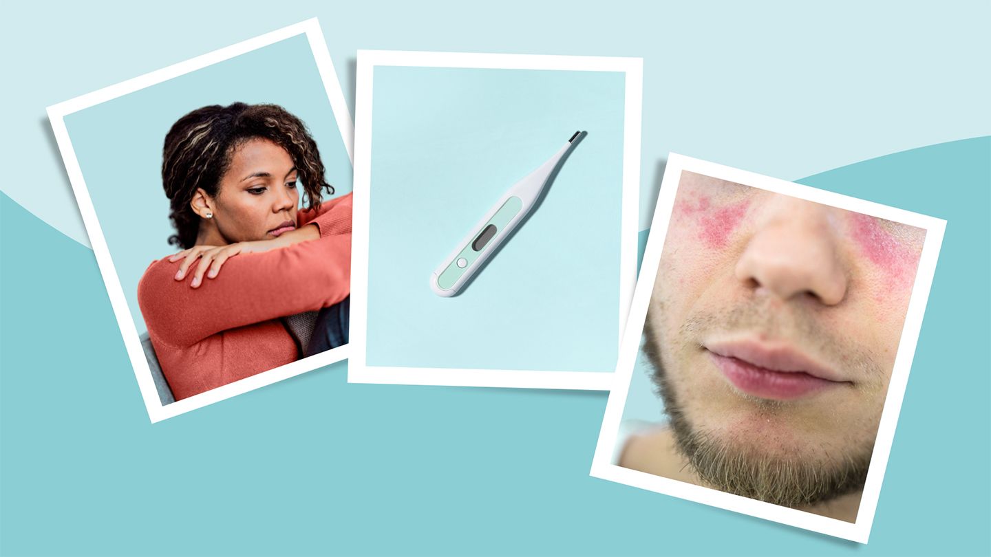 Lupus Symptoms